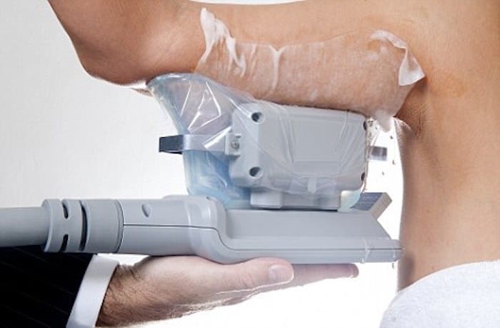 fat freezing arms Worthing