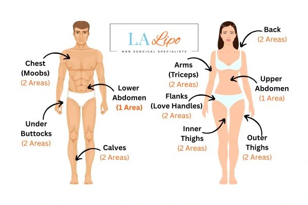 LA LIPO Cryolipolysis Areas Worthing
