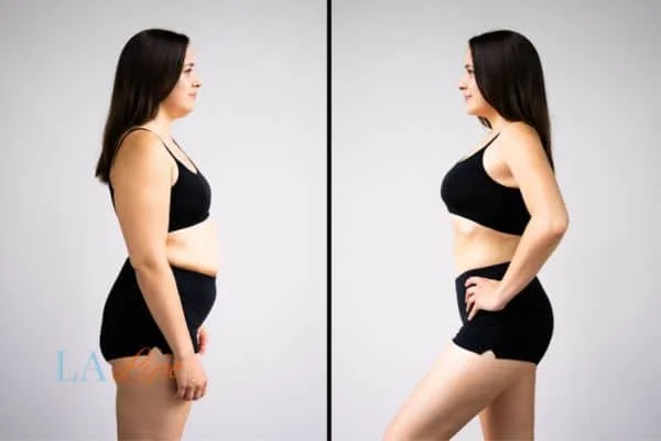 link between body image and mental health Worthing