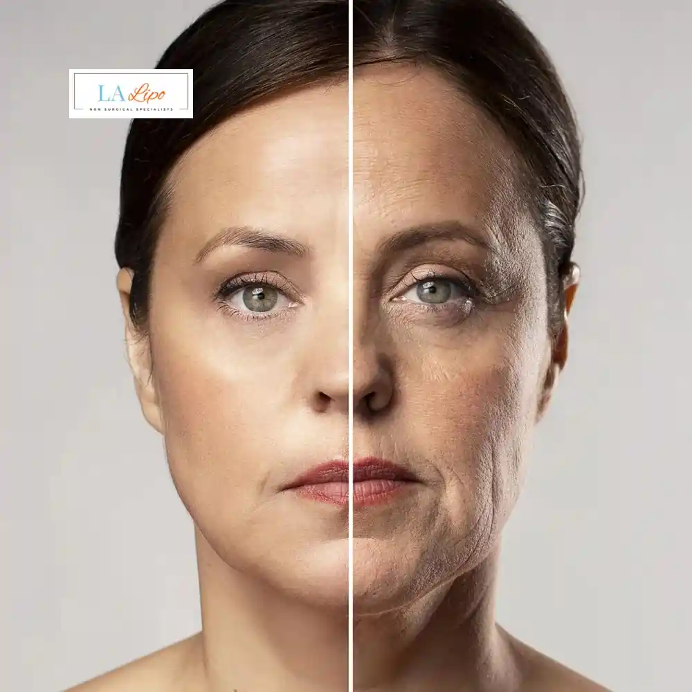 How Can You Tell If Non-Surgical Skin Tightening Is Right for You Worthing?