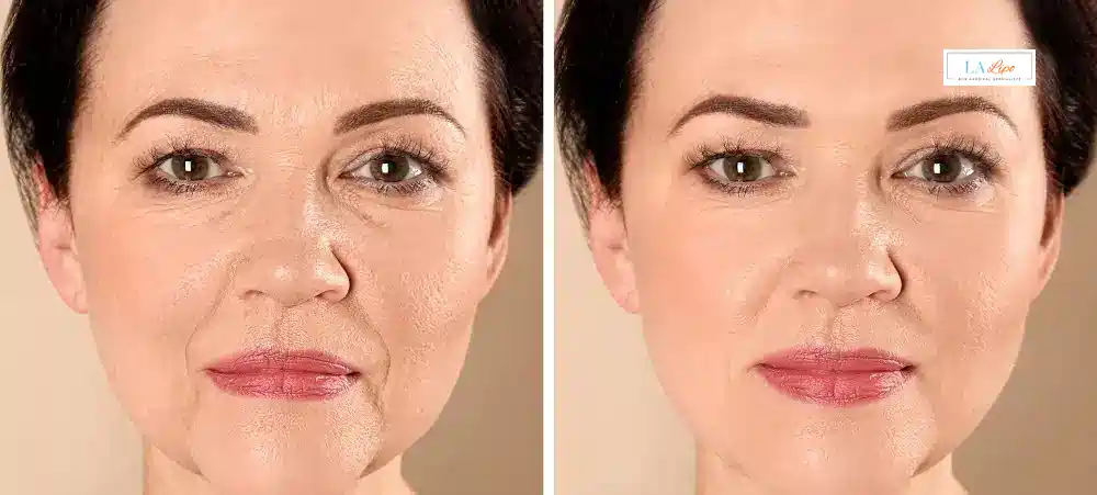 How Long Does It Take to See Results and How Long Do They Last Worthing?