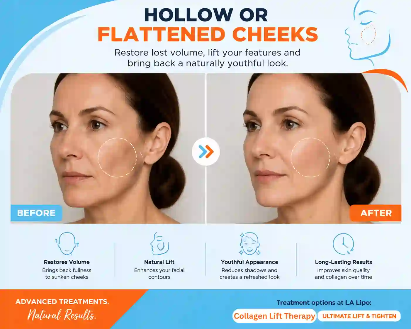 Sign #4: Hollow or Flattened Cheeks Worthing